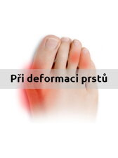 Ortopedické pomůcky při deformaci prstů